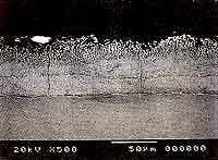 写真7　ステンレスと接合した亜鉛めっき鋼板暴露面の顕微鏡写真（横浜）